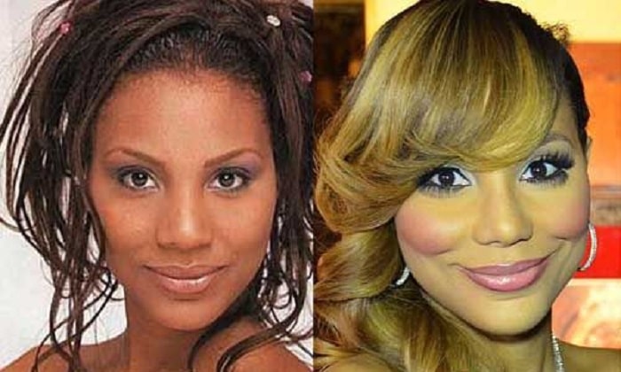 The alleged before and after pictures of Tamar's contour surgery.